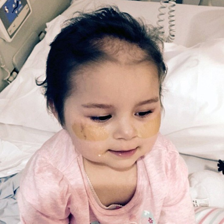 Η 4χρονη που είχε λίγες εβδομάδες ζωής και «εξαφάνισε» δώδεκα όγκους - Εικόνα 5