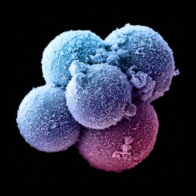 10 Φανταστικές εικόνες που δείχνουν τα στάδια εξέλιξης ενός εμβρύου - Εικόνα 1