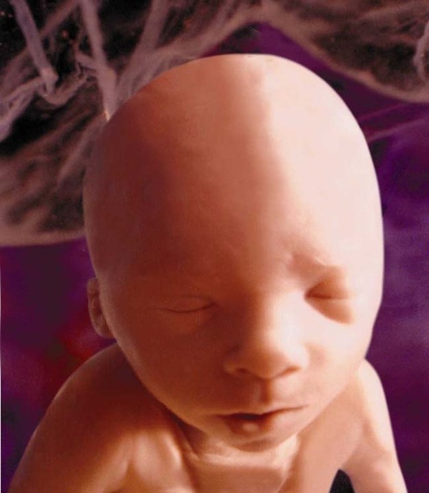 10 Φανταστικές εικόνες που δείχνουν τα στάδια εξέλιξης ενός εμβρύου - Εικόνα 8