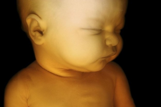 10 Φανταστικές εικόνες που δείχνουν τα στάδια εξέλιξης ενός εμβρύου - Εικόνα 9