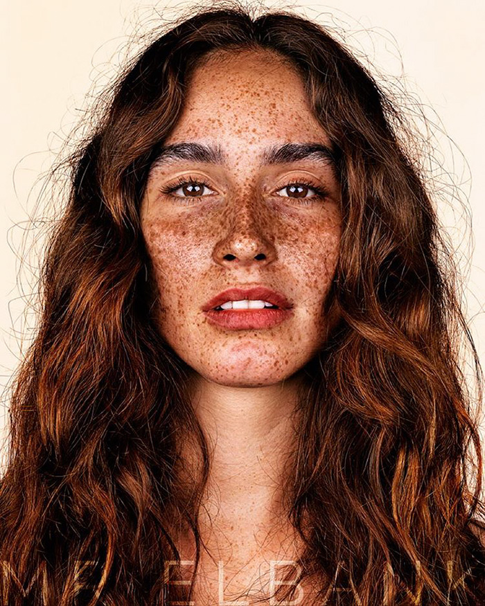 Η μοναδική ομορφιά των ανθρώπων με φακίδες απαθανατισμένη από τον Brock Elbank - Εικόνα 13
