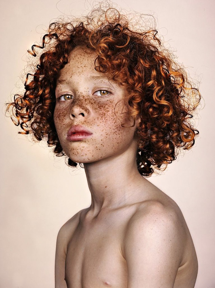 Η μοναδική ομορφιά των ανθρώπων με φακίδες απαθανατισμένη από τον Brock Elbank - Εικόνα 19