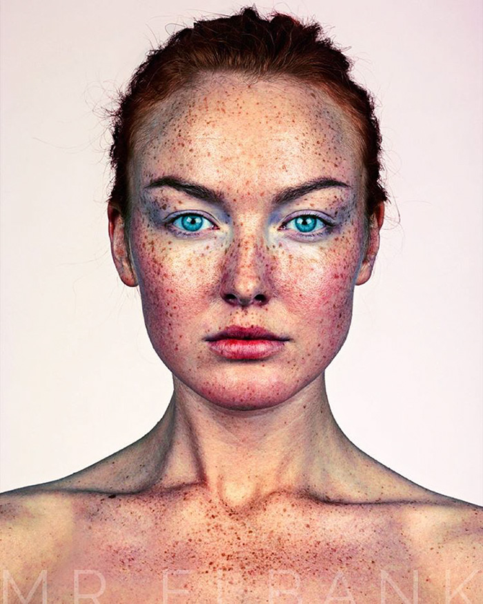 Η μοναδική ομορφιά των ανθρώπων με φακίδες απαθανατισμένη από τον Brock Elbank - Εικόνα 28