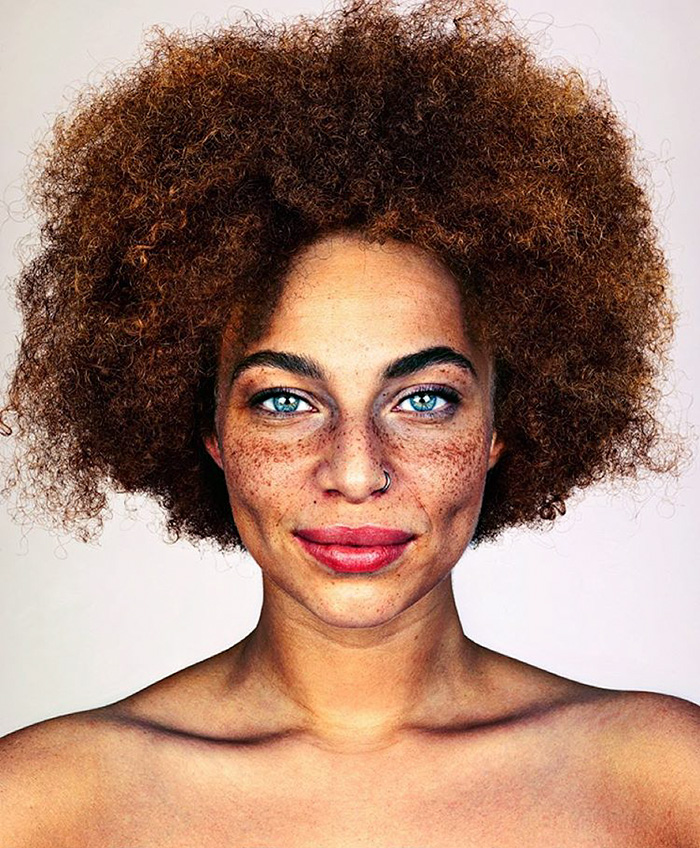 Η μοναδική ομορφιά των ανθρώπων με φακίδες απαθανατισμένη από τον Brock Elbank - Εικόνα 4