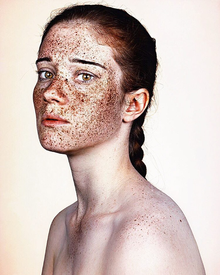 Η μοναδική ομορφιά των ανθρώπων με φακίδες απαθανατισμένη από τον Brock Elbank - Εικόνα 43