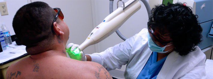 Προσφέρουν ένα νέο ξεκίνημα σε φυλακισμένους κάνοντας τους δωρεάν αφαίρεση tattoo - Εικόνα 2