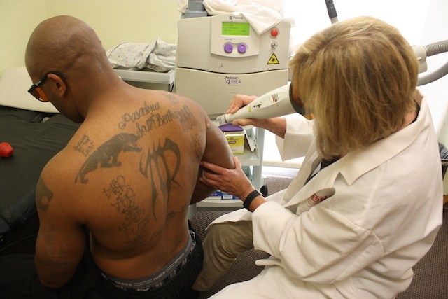 Προσφέρουν ένα νέο ξεκίνημα σε φυλακισμένους κάνοντας τους δωρεάν αφαίρεση tattoo - Εικόνα 3