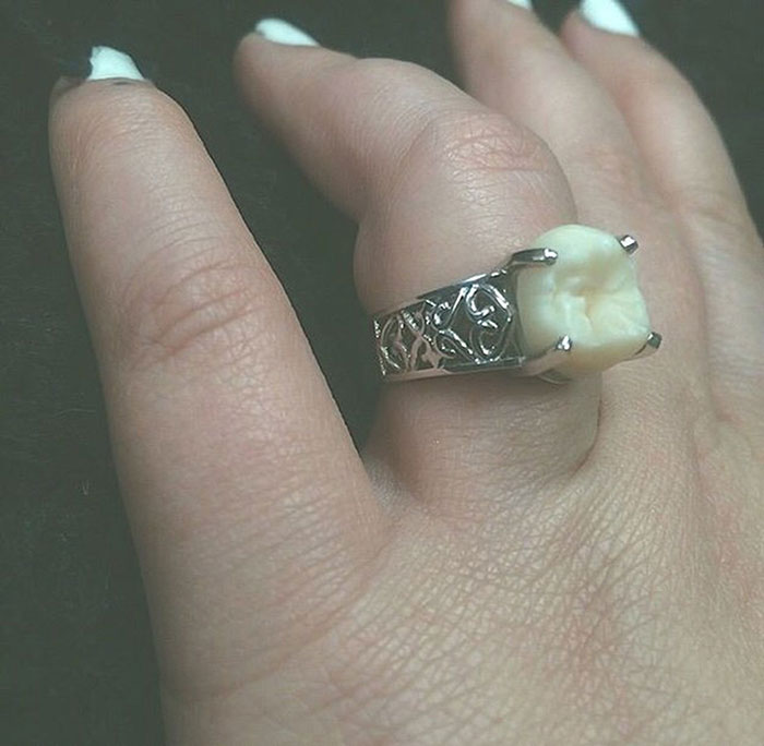 Απίστευτο με τι δαχτυλίδι της έκανε πρόταση γάμου! - Εικόνα 5