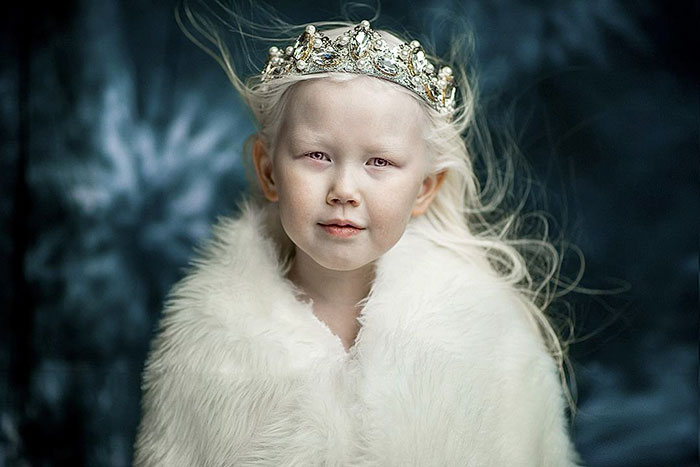 Nariyana: Η 8χρονη Αλμπίνο Πριγκίπισσα από τη Σιβηρία - Εικόνα 1