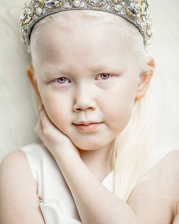 Nariyana: Η 8χρονη Αλμπίνο Πριγκίπισσα από τη Σιβηρία - Εικόνα 2