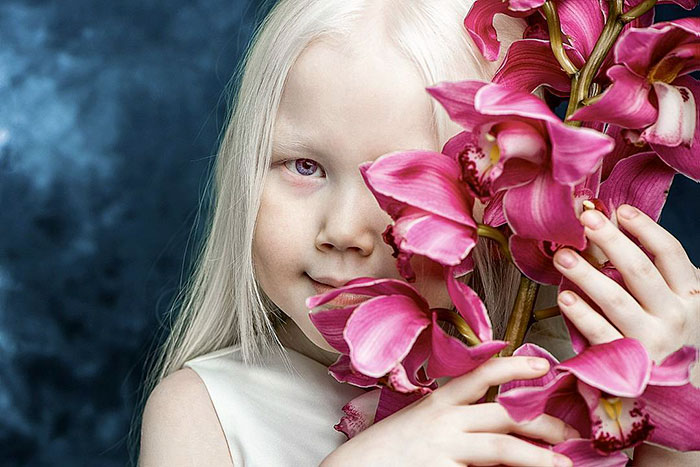 Nariyana: Η 8χρονη Αλμπίνο Πριγκίπισσα από τη Σιβηρία - Εικόνα 3