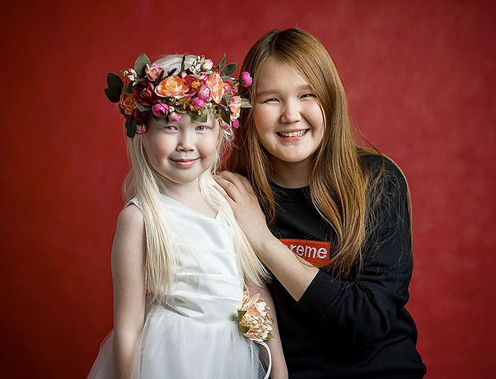 Nariyana: Η 8χρονη Αλμπίνο Πριγκίπισσα από τη Σιβηρία - Εικόνα 5