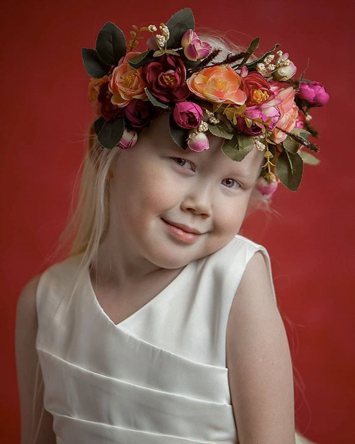 Nariyana: Η 8χρονη Αλμπίνο Πριγκίπισσα από τη Σιβηρία - Εικόνα 7