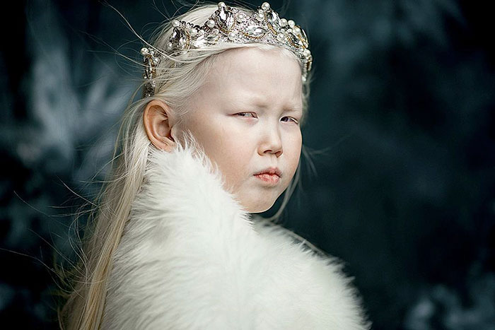Nariyana: Η 8χρονη Αλμπίνο Πριγκίπισσα από τη Σιβηρία - Εικόνα 8