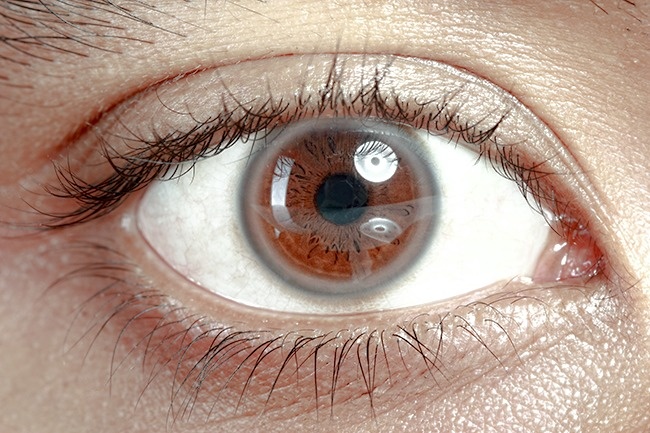 12 σημάδια που εμφανίζουν τα μάτια μας όταν έχουμε πρόβλημα με την υγεία μας - Εικόνα 2