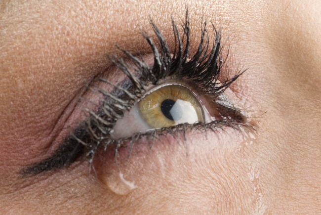 12 σημάδια που εμφανίζουν τα μάτια μας όταν έχουμε πρόβλημα με την υγεία μας - Εικόνα 8