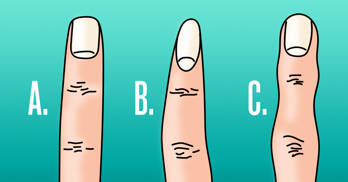 Διαβάστε τα χέρια σας: το σχήμα των δαχτύλων μπορεί να πει πολλά για ένα άτομο.