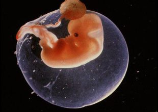 Επιστήμονες καλλιέργησαν ανθρώπινο έμβρυο δύο εβδομάδων...
