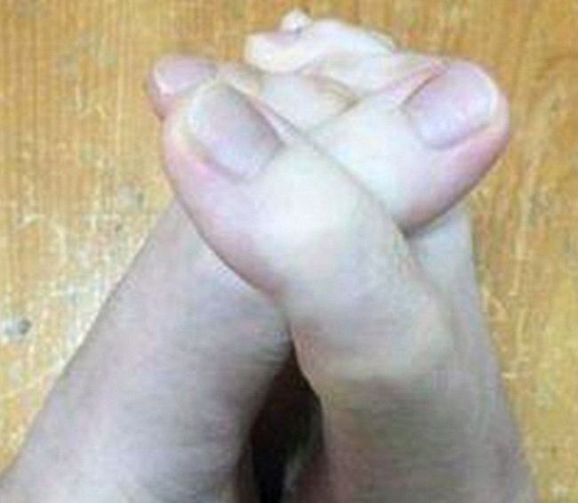 Τα δάχτυλα των ποδιών που έγιναν "viral" στο διαδίκτυο !!!