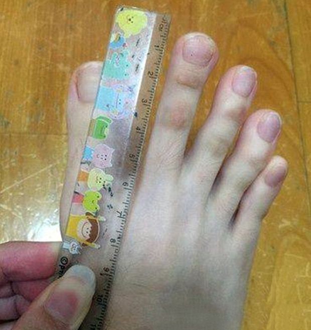 Τα δάχτυλα των ποδιών που έγιναν "viral" στο διαδίκτυο !!!