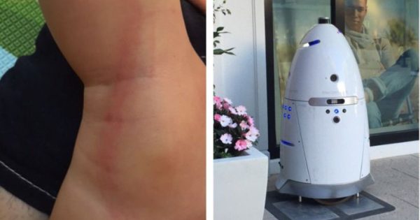 Ρομπότ κατηγορείται ότι «επιτέθηκε» σε αγοράκι 16 μηνών