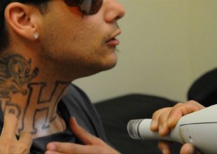 Προσφέρουν ένα νέο ξεκίνημα σε φυλακισμένους κάνοντας τους δωρεάν αφαίρεση tattoo