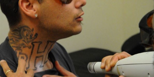 Προσφέρουν ένα νέο ξεκίνημα σε φυλακισμένους κάνοντας τους δωρεάν αφαίρεση tattoo
