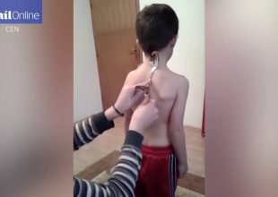 Το 5χρονο αγόρι – «μαγνήτης» από τη Βοσνία Ερζεγοβίνη