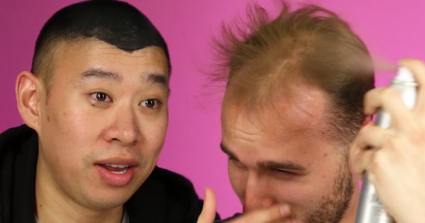 Άντρες με αραίωση ΨΕΚΑΖΟΥΝ μαλλιά στο κεφάλι τους!!