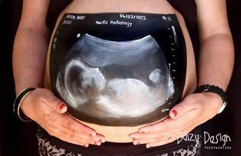 Μια διαφορετική φωτογραφία εγκυμοσύνης που μας έκανε να χαμογελάσουμε!