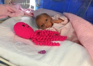 Πλεκτά χταποδάκια σώζουν τις ζωές πρόωρων μωρών στα νοσοκομεία