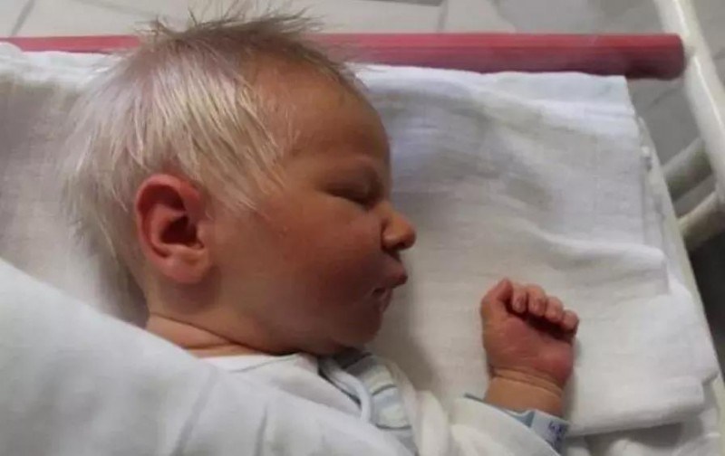 Ο "Μικρός Πρίγκιπας" που γεννήθηκε με κάτασπρα μαλλιά και έχει ξετρελάνει το διαδίκτυο!
