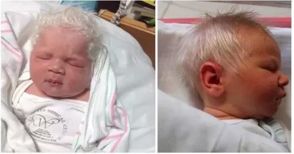 Ο "Μικρός Πρίγκιπας" που γεννήθηκε με κάτασπρα μαλλιά και έχει ξετρελάνει το διαδίκτυο!