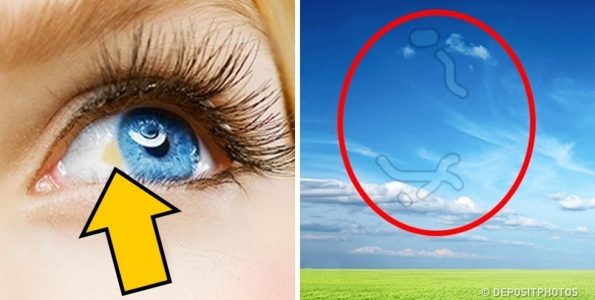 12 σημάδια που εμφανίζουν τα μάτια μας όταν έχουμε πρόβλημα με την υγεία μας